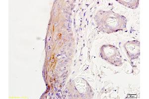 Immunohistochemistry (IHC) image for anti-Glutamate Receptor, Ionotropic, N-Methyl D-Aspartate 2a (GRIN2A) (AA 851-950) antibody (ABIN747353)