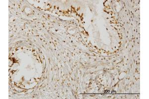 Immunoperoxidase of monoclonal antibody to KLHDC4 on formalin-fixed paraffin-embedded human prostate. (KLHDC4 抗体  (AA 1-463))