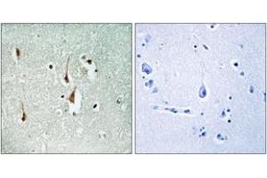 Immunohistochemistry (IHC) image for anti-Cyclin D1 (CCND1) (AA 246-295) antibody (ABIN2888623) (Cyclin D1 抗体  (AA 246-295))