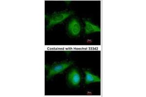 ICC/IF Image Immunofluorescence analysis of methanol-fixed HeLa, using HSC70, antibody at 1:200 dilution. (Hsc70 抗体  (C-Term))