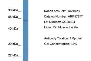 Western Blotting (WB) image for anti-Tektin 3 (TEKT3) (N-Term) antibody (ABIN2787333) (Tektin 3 抗体  (N-Term))