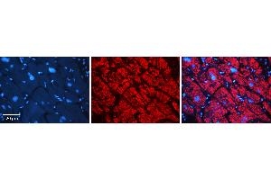 Rabbit Anti-AKR1B1 Antibody Catalog Number: ARP48179_P050 Formalin Fixed Paraffin Embedded Tissue: Human heart Tissue Observed Staining: Cytoplasmic Primary Antibody Concentration: N/A Other Working Concentrations: 1:600 Secondary Antibody: Donkey anti-Rabbit-Cy3 Secondary Antibody Concentration: 1:200 Magnification: 20X Exposure Time: 0. (AKR1B1 抗体  (N-Term))
