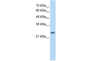 WB Suggested Anti-TSHR Antibody Titration:  0. (TSH receptor 抗体  (C-Term))