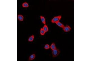 Immunofluorescent analysis of GPR126 staining in LOVO cells. (G Protein-Coupled Receptor 126 抗体)