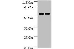 Western blot All lanes: Ces1c antibody at 2 μg/mL Lane 1: Mouse liver tissue Lane 2: Rat liver tissue Secondary Goat polyclonal to rabbit IgG at 1/10000 dilution Predicted band size: 62 kDa Observed band size: 62 kDa (CES1C 抗体  (AA 19-550))
