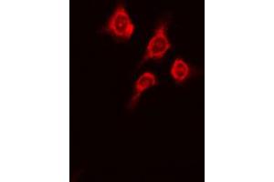 ABIN6269362 staining A431 cells by IF/ICC. (PKC mu 抗体  (Internal Region))