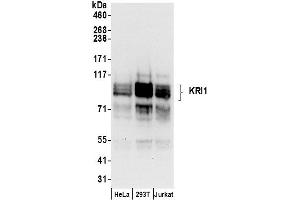 anti-KRI1 Homolog (KRI1) (AA 200-250) antibody