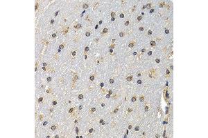 Immunohistochemistry (IHC) image for anti-Deoxyribonuclease I (DNASE1) (AA 22-282) antibody (ABIN3016215) (DNASE1 抗体  (AA 22-282))