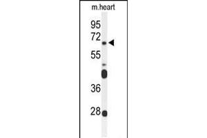 Western blot analysis of FZD4 Antibody in mouse heart tissue lysates (35ug/lane) (FZD4 抗体  (C-Term))