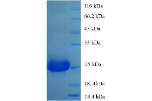 SDS-PAGE (SDS) image for Parvalbumin alpha (PRVA) (AA 2-110) protein (His-SUMO Tag) (ABIN5710191)