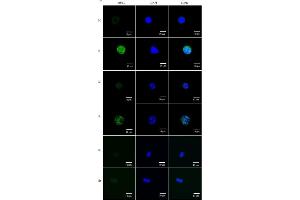 Effect of protein kinase C (PKC)-δ activation on MUC2 expression.
