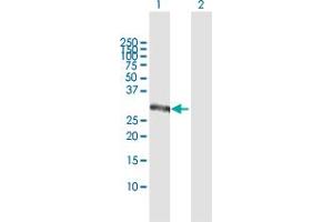 Western Blot analysis of CSGALNACT1 expression in transfected 293T cell line by CSGALNACT1 MaxPab polyclonal antibody. (CSGALNACT1 抗体  (AA 1-297))