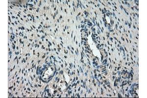 Immunohistochemical staining of paraffin-embedded Ovary tissue using anti-FERMT2mouse monoclonal antibody. (FERMT2 抗体)