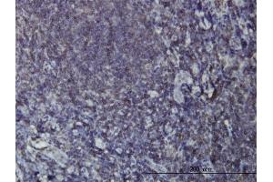 Immunoperoxidase of monoclonal antibody to EPHB3 on formalin-fixed paraffin-embedded human tonsil. (EPH Receptor B3 抗体  (AA 899-997))