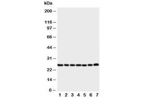 Western blot testing of SIP antibody and Lane 1:  rat liver (CACYBP 抗体  (Middle Region))