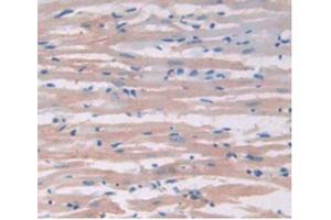 IHC-P analysis of Rat Heart Tissue, with DAB staining. (IL-6 抗体  (AA 21-211))