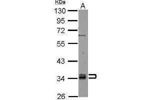 Western Blotting (WB) image for anti-Rab Geranylgeranyltransferase, beta Subunit (RABGGTB) antibody (ABIN2856206)