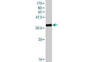 Western Blot detection against Immunogen (36. (HSD17B3 抗体  (AA 29-119))