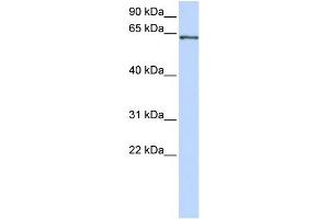 WB Suggested Anti-RELA Antibody Titration:  0. (NF-kB p65 抗体  (Middle Region))
