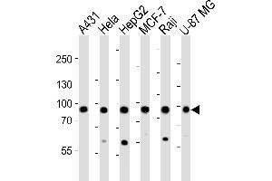 Western blot analysis of lysates from A431, Hela, HepG2, MCF-7, Raji, U-87 MG cell line (from left to right), using IT Antibody (Center) (ABIN6242975 and ABIN6577493). (IMMT 抗体  (AA 170-203))