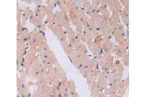 Used in DAB staining on fromalin fixed paraffin- embedded heart tissue (PLA2G3 抗体  (AA 20-268))