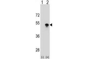 Western Blotting (WB) image for anti-Small Nuclear RNA Activating Complex, Polypeptide 1, 43kDa (SNAPC1) (AA 138-168), (Middle Region) antibody (ABIN954868)