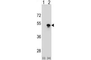 Western blot analysis of SNAPC1 (arrow) using rabbit polyclonal SNAPC1 Antibody (Center) . (SNAPC1 抗体  (Middle Region))