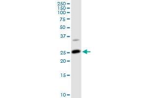 ARHGDIA MaxPab rabbit polyclonal antibody. (ARHGDIA 抗体  (AA 1-204))