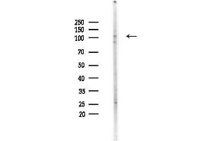 anti-General Transcription Factor II I Repeat Domain-Containing 1 (GTF2IRD1) (N-Term) antibody
