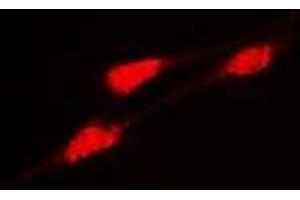 Immunofluorescent analysis of DLGAP5 staining in Hela cells. (DLGAP5 抗体)