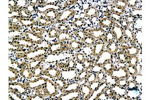 Formalin-fixed and paraffin embedded rat kidney tissue labeled with Anti-Claudin 5 Polyclonal Antibody, Unconjugated (ABIN673869) followed by conjugation to the secondary antibody and DAB staining (Claudin 5 抗体)