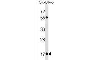 RAB19 Antibody (N-term) (ABIN1538880 and ABIN2850090) western blot analysis in SK-BR-3 cell line lysates (35 μg/lane). (RAB19 抗体  (N-Term))