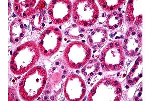 IHC Information: Paraffin embedded renaltubules tissue, tested with an antibody dilution of 5 ug/ml. (T-Box 18 抗体  (C-Term))