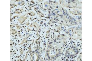 IHC analysis of SCP3/SYCP3 using anti-SCP3/SYCP3 antibody (ABIN7602415). (SYCP3 抗体  (AA 75-236))