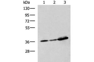Western blot analysis of A549 A172 and HepG2 cell lysates using EEF1D Polyclonal Antibody at dilution of 1:950 (EEF1D 抗体)