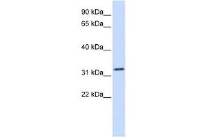 Tropomyosin 1 antibody used at 1 ug/ml to detect target protein. (Tropomyosin 抗体)
