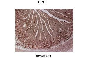 Immunohistochemistry (IHC) image for anti-Carbamoyl-Phosphate Synthase 1, Mitochondrial (CPS1) (Middle Region) antibody (ABIN2782319)