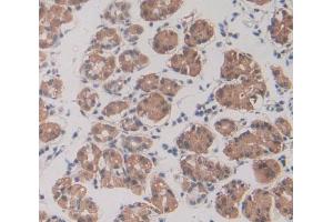 Used in DAB staining on fromalin fixed paraffin- embedded stomach tissue (GRF2 抗体  (AA 780-1035))