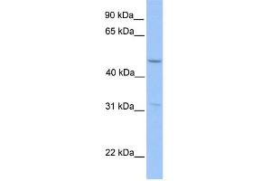 WB Suggested Anti-ZNF342 Antibody Titration:  0. (Zinc Finger Protein 296 (ZNF296) (Middle Region) 抗体)