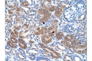 CD36 antibody was used for immunohistochemistry at a concentration of 4-8 ug/ml. (CD36 抗体)