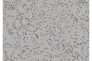 ABIN6273635 at 1/100 staining Rat kidney tissue by IHC-P. (HSPB3 抗体  (Internal Region))