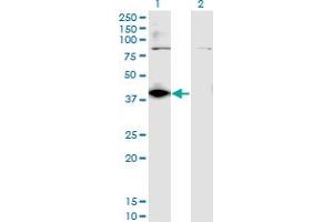 Western Blot analysis of DHDH expression in transfected 293T cell line by DHDH monoclonal antibody (M03), clone 3A11. (DHDH 抗体  (AA 235-334))