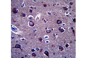 Anti-APP antibody immunohistochemistry analysis in formalin fixed and paraffin embedded human brain tissue. (APP 抗体  (AA 333-362))