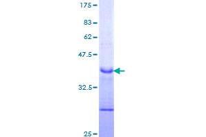 Image no. 1 for Notch 1 (NOTCH1) (AA 23-132) protein (GST tag) (ABIN1312809) (Notch1 Protein (AA 23-132) (GST tag))