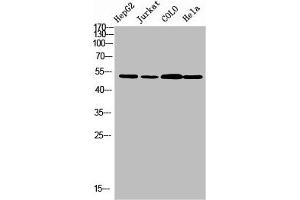 Western blot analysis of HepG2 JK Colo Hela using TRMT11 antibody. (Trmt11 抗体  (C-Term))