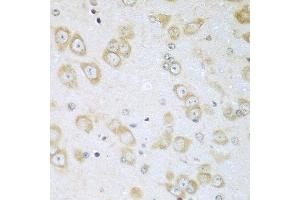Immunohistochemistry of paraffin-embedded mouse brain using ACOX1 antibody at dilution of 1:100 (40x lens). (ACOX1 抗体)