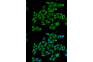 Immunofluorescence analysis of HeLa cell using BLZF1 antibody. (BLZF1 抗体)