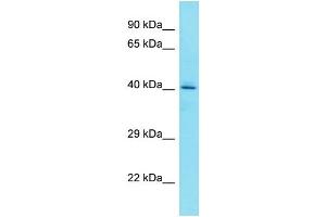 Host: Rabbit Target Name: FAM203A Sample Type: HepG2 Whole Cell lysates Antibody Dilution: 1. (FAM203B 抗体  (C-Term))