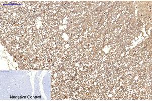Immunohistochemical analysis of paraffin-embedded rat spinal cord tissue. (MICU1 抗体)