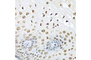 Immunohistochemistry of paraffin-embedded human liver using UBC antibody. (UBC 抗体  (AA 1-100))